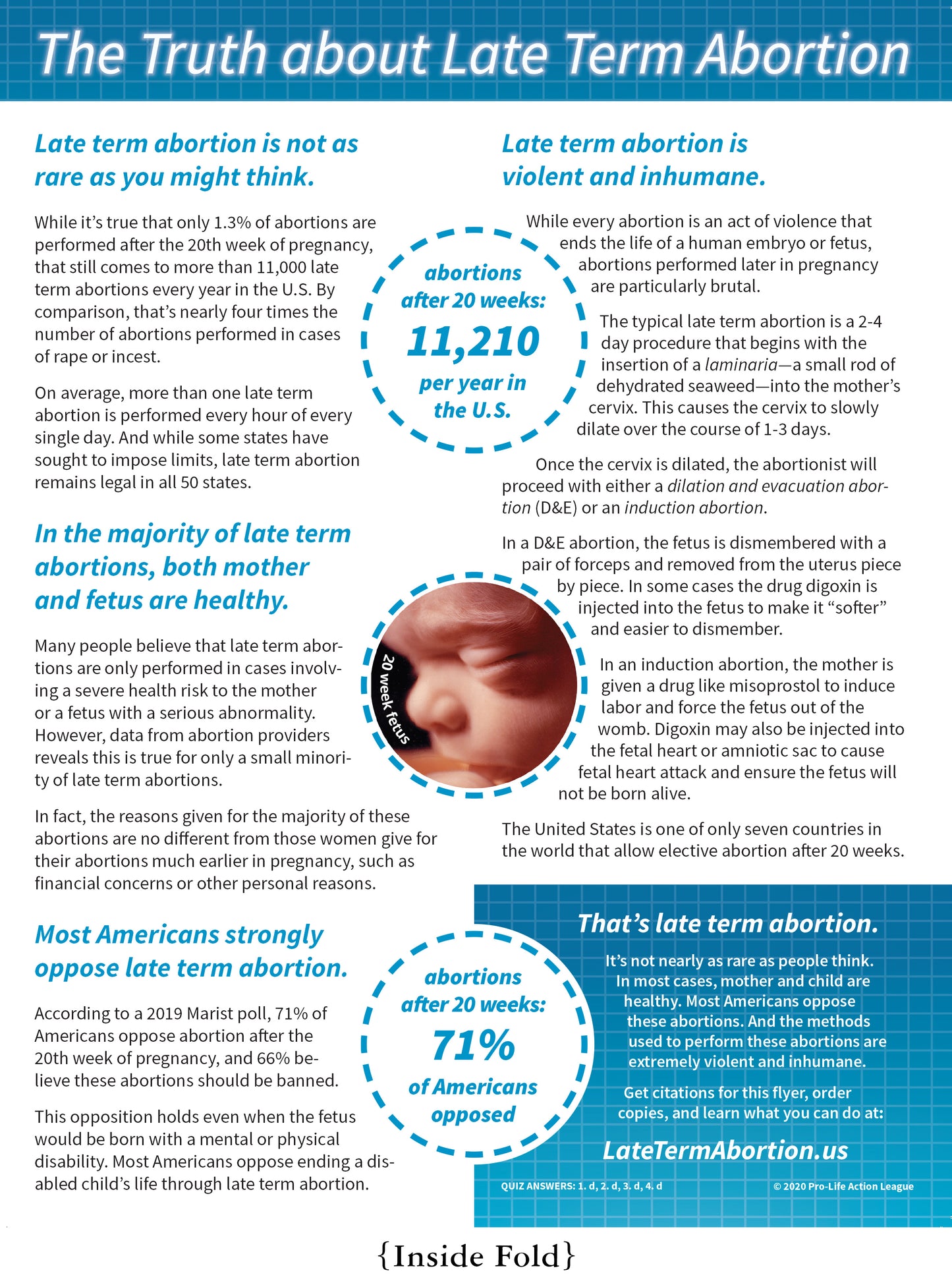 "Understanding Abortion Later in Pregnancy" flyer (100 count)